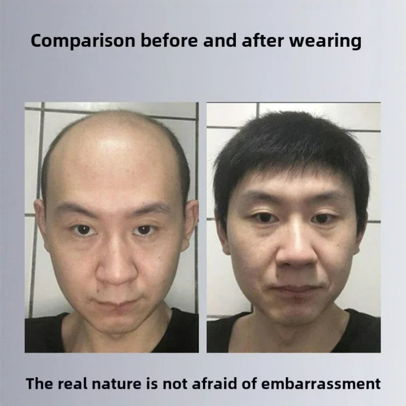 Hair topper shown before and after application