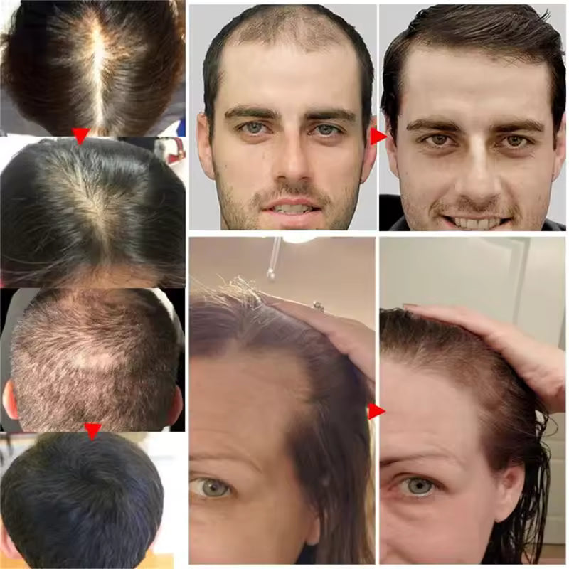 Advanced Copper Peptide Hair Growth & Scalp Revitalizing Serum