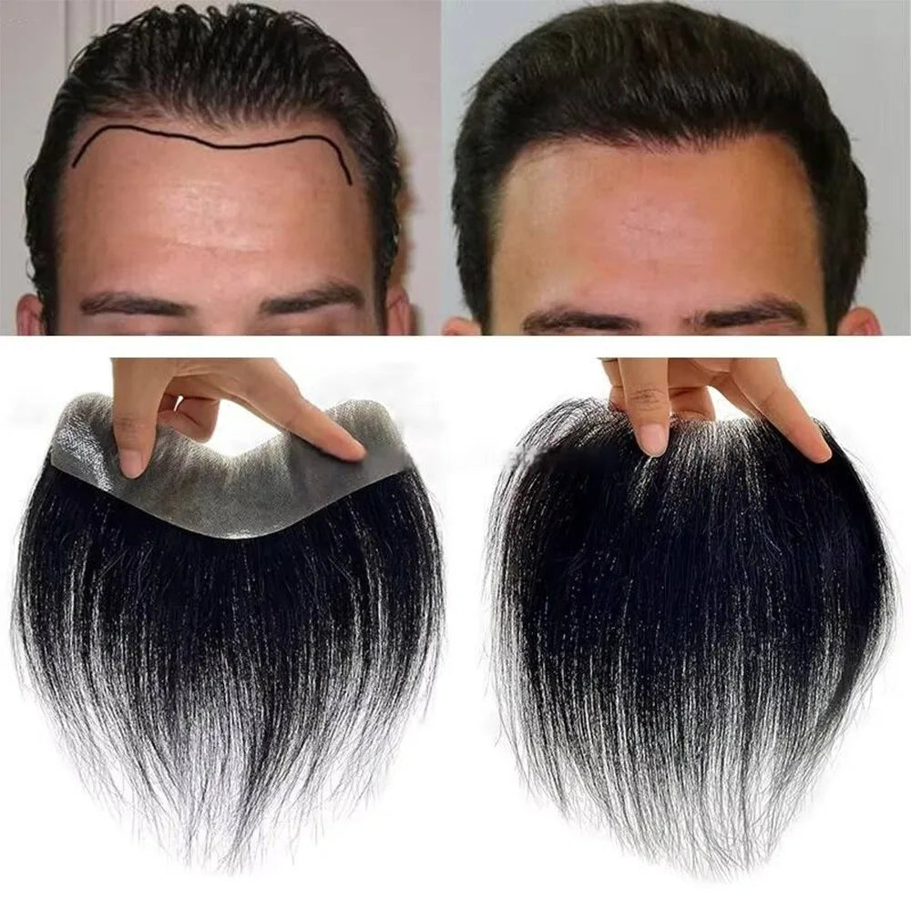 Frontal hairpiece with hairline and base construction views