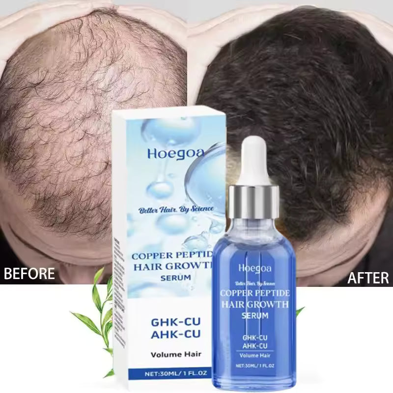 Advanced Copper Peptide Hair Growth & Scalp Revitalizing Serum