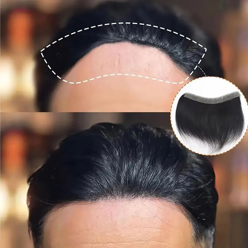 Frontal hairpiece with hairline and base construction views